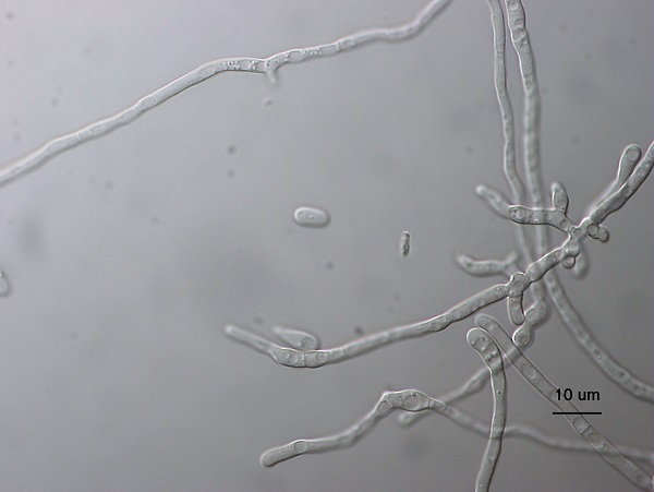 カビの細胞の位相差顕微鏡画像
