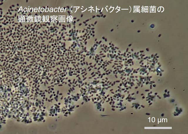 Acinetobacter（アシネトバクター）属細菌の顕微鏡観察画像