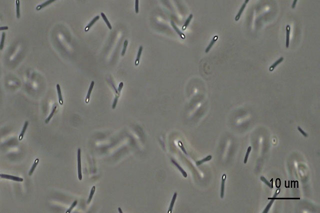 細菌の芽胞の写真