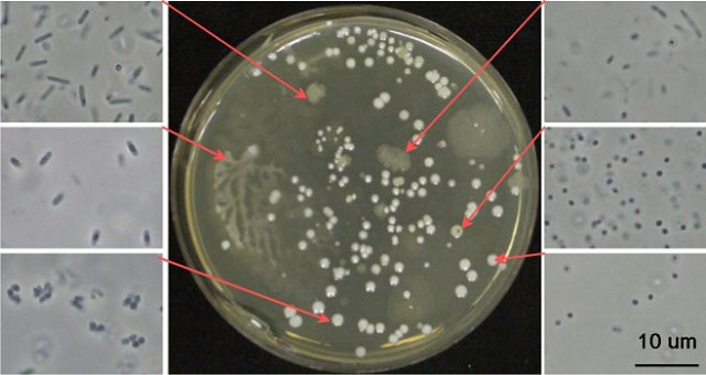 寒天培地上の細菌のコロニーと顕微鏡観察画像