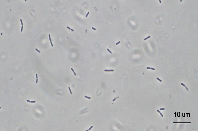細長い形状の細菌（桿菌）の位相差顕微鏡観察像