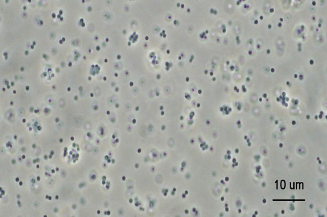 球状の細菌（球菌）の位相差顕微鏡観察像